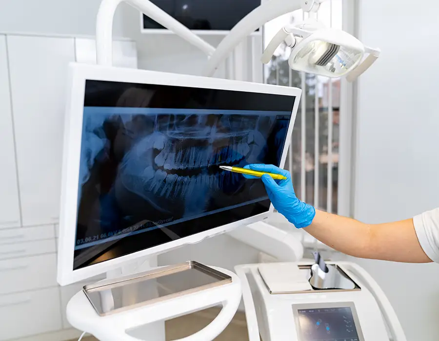 Компьютерная и минимально инвазивная хирургия - Стоматологическая практика в Брешии - доктор Ирина Гараева