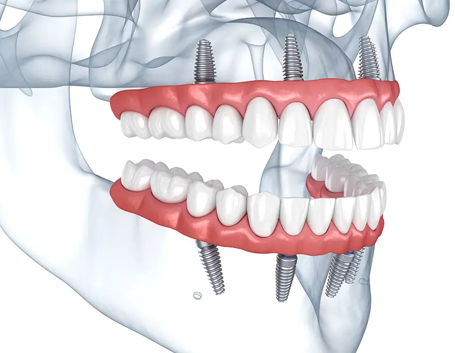 Углубленная диагностика и передовые технологии для стабильных и долговременных результатов - Стоматологическая практика в Брешии - доктор Ирина Гараева