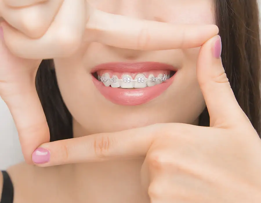 Ортодонтия для взрослых - Стоматологическая практика в Брешии - Доктор Ирина Гараева