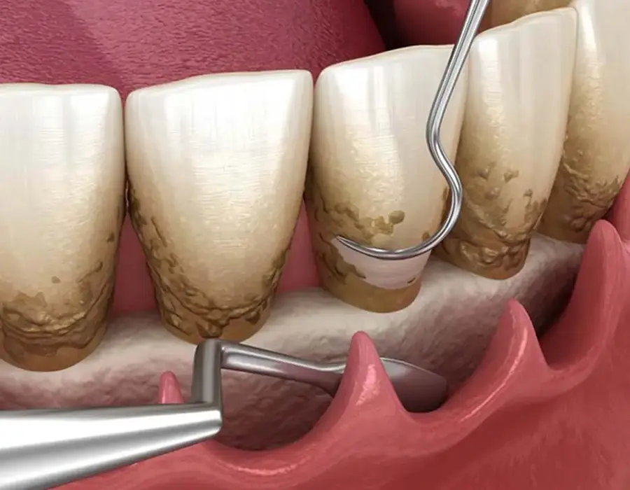 Каузальная терапия - Стоматологическая практика в Брешии - доктор Ирина Гараева