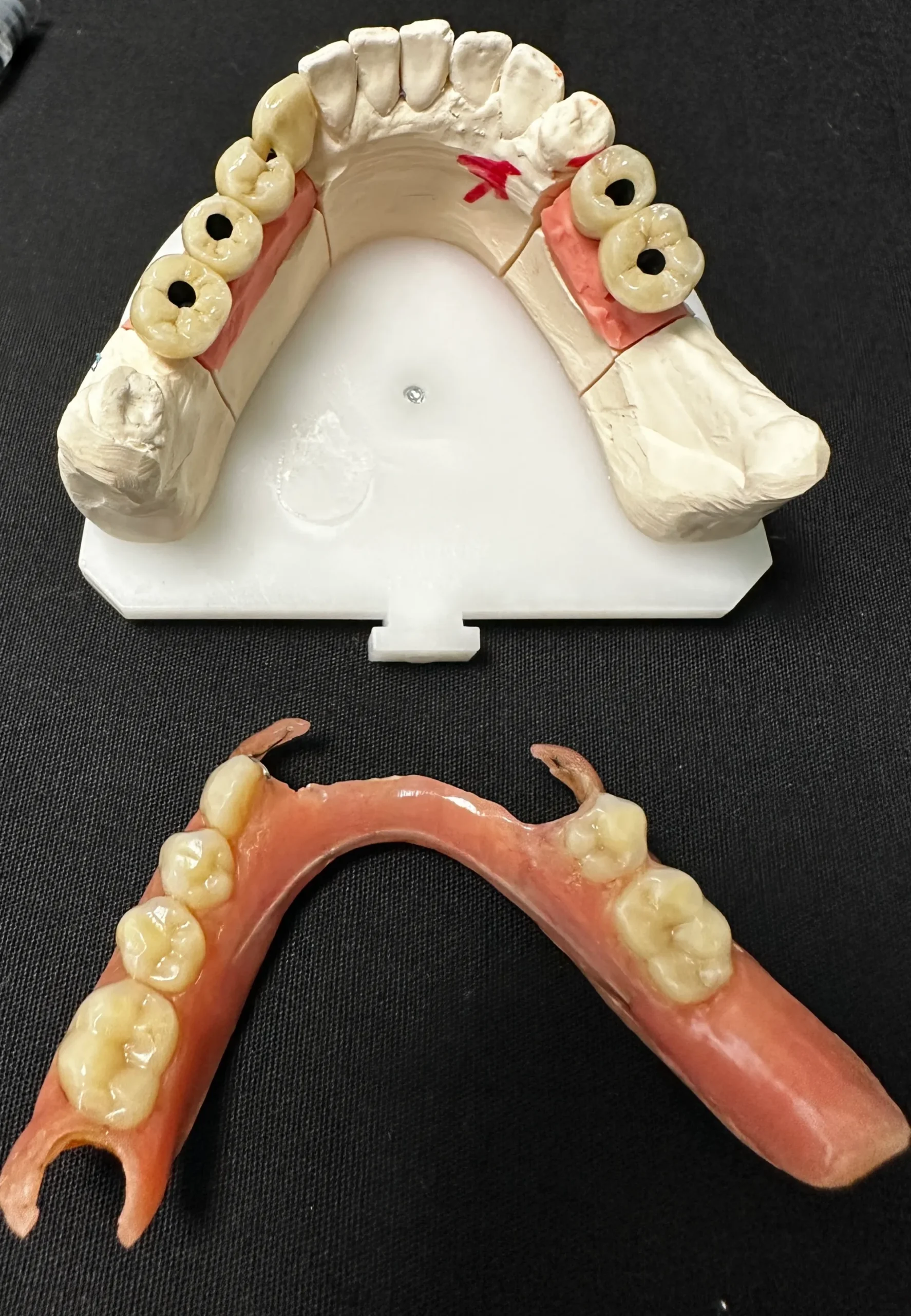 Мобильное протезирование - Стоматологическая практика в Брешии - доктор Ирина Гараева