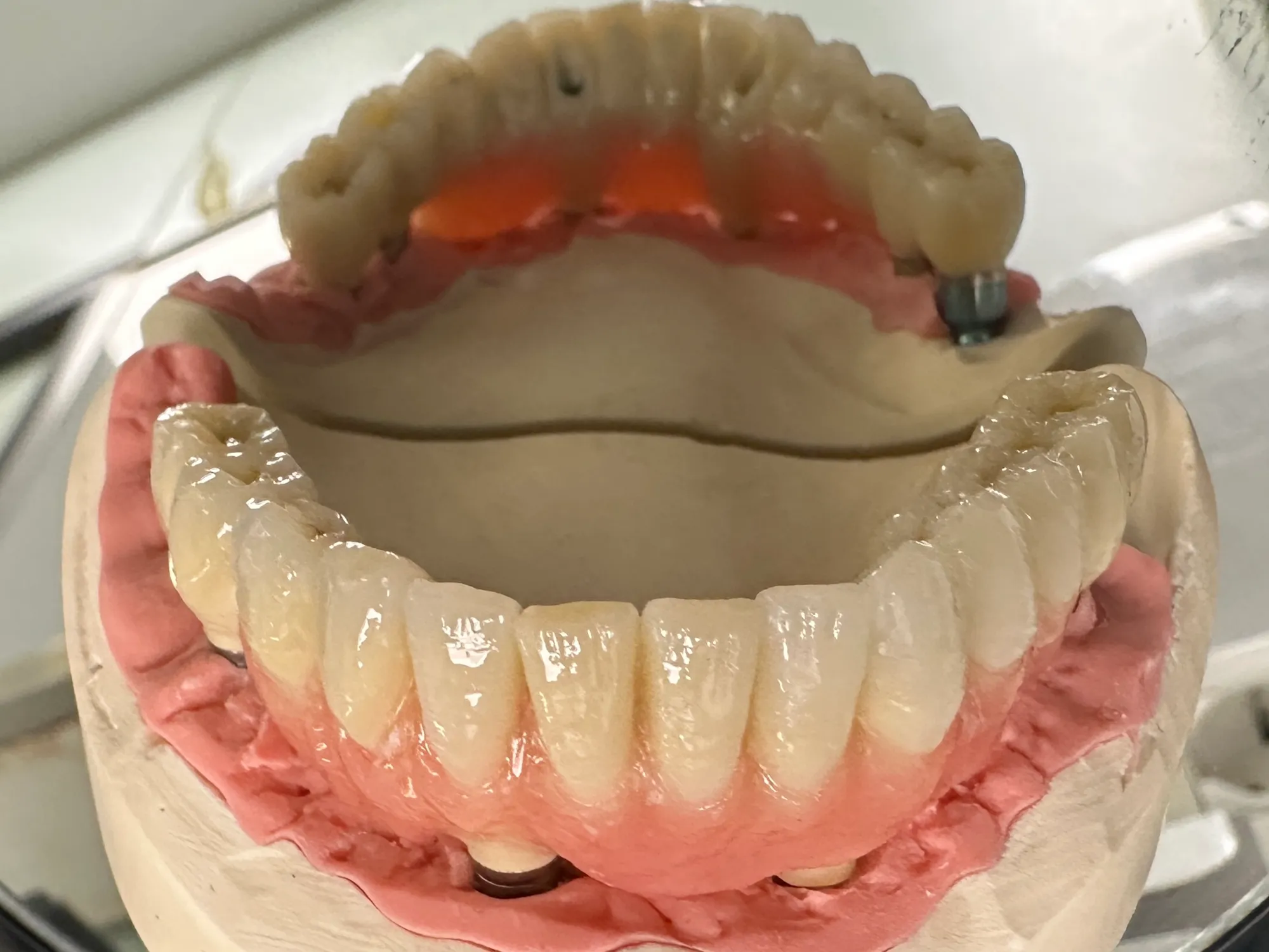 Гнатология - Стоматологическая практика в Брешии - доктор Ирина Гараева