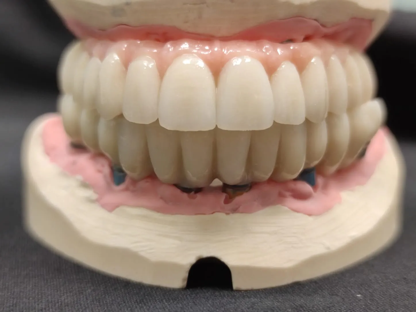 Индивидуальное лечение, новое качество жизни - Стоматологическая практика в Брешии - доктор Ирина Гараева